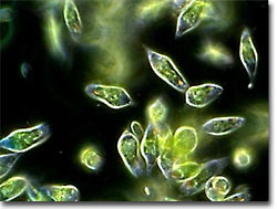 pond microorganisms