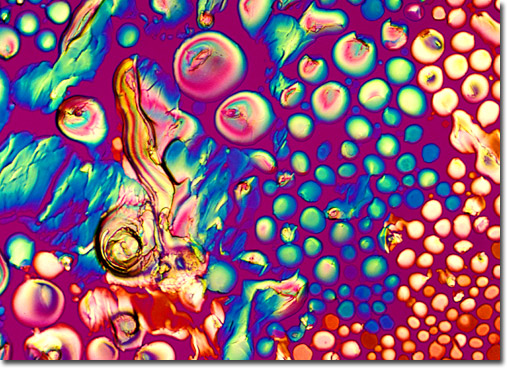 Photomicrograph of a pearl