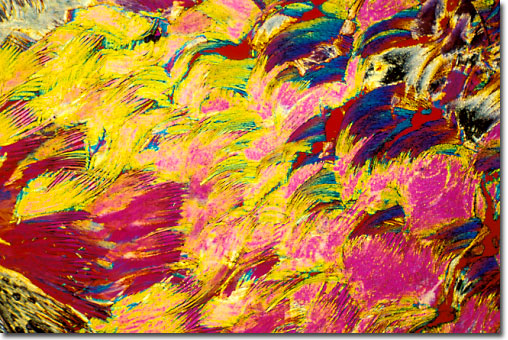 Photograph of Hydroxyproline under the microscope.