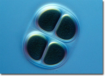 Chroococcus Cyanobacteria