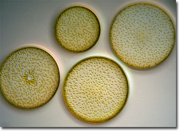 Coscinodiscus Diatoms