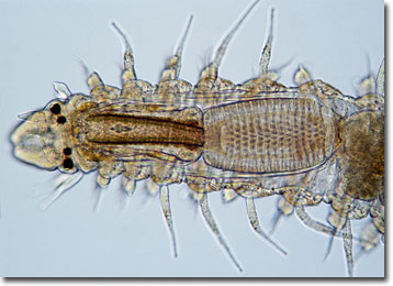 Polychaete Head