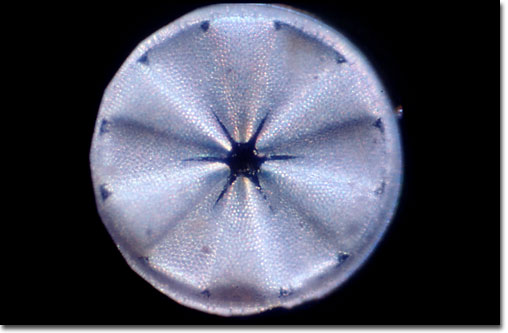 Diatom (Actinoptychus)