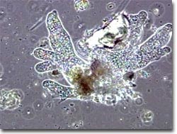 amoeba under microscope 100x labeled