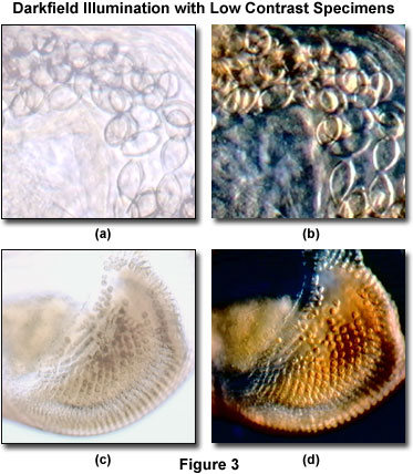 Molecular Expressions: Science, Optics & You - Olympus MIC-D: Darkfield  Gallery - Lycra Spandex