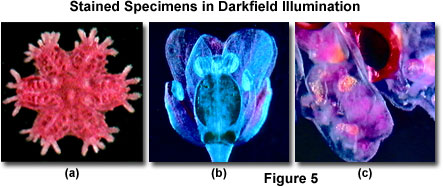 Molecular Expressions: Science, Optics & You - Olympus MIC-D: Brightfield  Gallery - Human Bladder