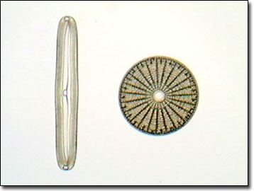 diatoms under microscope labeled