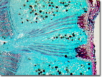 calcium oxalate crystals in plants