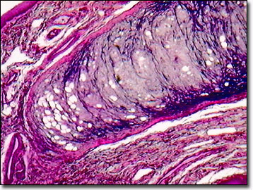 elastic cartilage epiglottis labeled