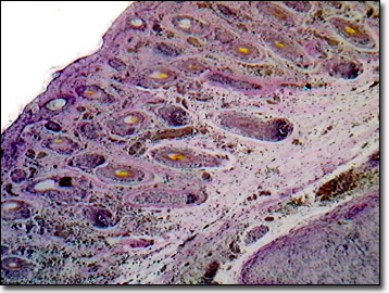 lacunae cartilage