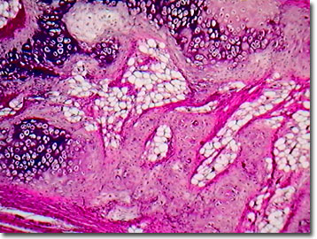 elastic cartilage epiglottis labeled