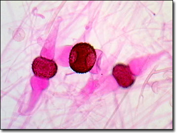 rhizopus under compound microscope