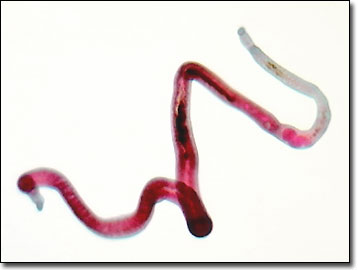 Molecular Expressions: Science, Optics & You - Olympus MIC-D: Brightfield  Gallery - Human Blood Fluke (Schistosoma mansoni)