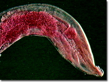 Molecular Expressions: Science, Optics & You - Olympus MIC-D: Darkfield  Gallery - Pinworms (Enterobius vermicularis)