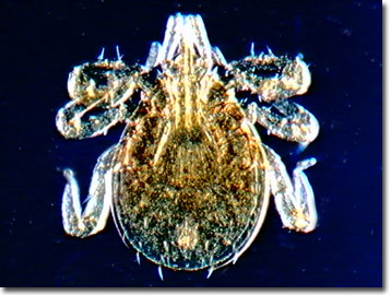 deer tick under microscope