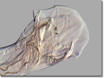 Hookworm - mouth of the organism: MedlinePlus Medical Encyclopedia Image