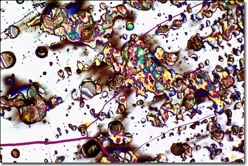 Photograph of Amoxicillin under the microscope.