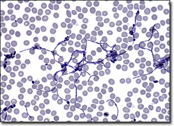 Molecular Expressions Microscopy Primer: Anatomy of the ... fungus cell diagram 