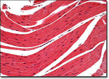 Molecular Expressions Microscopy Primer: Anatomy of the Microscope -  Brightfield Microscopy Digital Image Gallery - Frog Striated Muscle Tissue