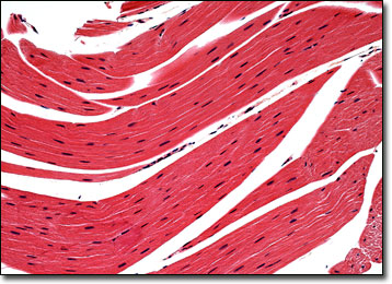 skeletal muscle tissue diagram