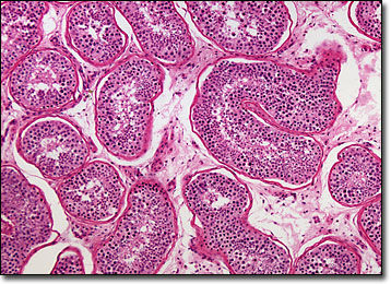 Molecular Expressions Microscopy Primer: Anatomy of the Microscope ...