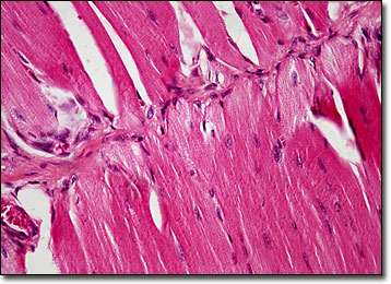 smooth muscle cells under microscope