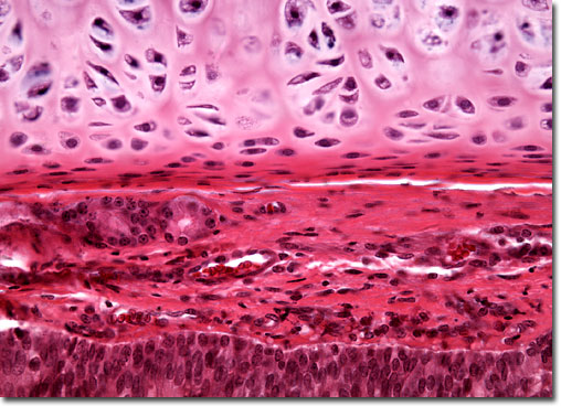 types of cartilage tissue