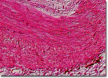 Molecular Expressions Microscopy Primer: Specialized Microscopy