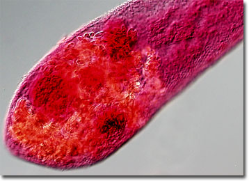 fluke under microscope