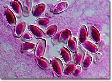 Molecular Expressions Microscopy Primer: Specialized Microscopy