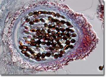 Ascospores Under Microscope