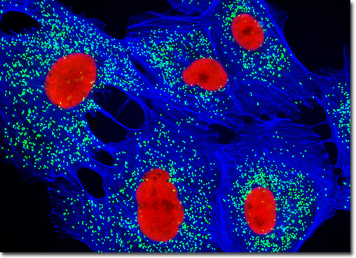 Immunofluorescent image of peroxisomal membrane protein