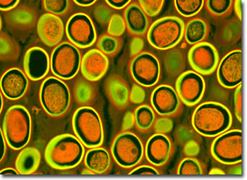 roundworms eggs in humans