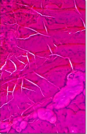 Molecular Expressions Microscopy Primer: Specialized Microscopy Techniques  - Phase Contrast Photomicrography Gallery - Fish Cycloid Scale