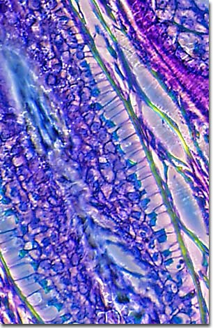 Aspergillus Cleistothecia Under the microscope mycosis microbiology