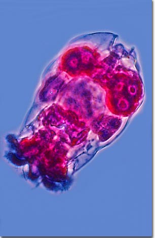 rotifer under a microscope